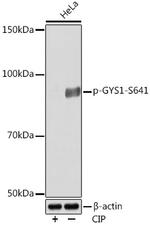 Phospho-GYS1 (Ser641) Antibody in Western Blot (WB)