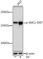 Phospho-SMC1 (Ser957) Antibody in Western Blot (WB)