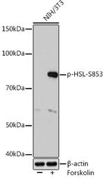 Phospho-HSL (Ser853) Recombinant Rabbit Monoclonal Antibody (6T6D8)