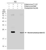 Enterovirus 71 3CD Monoclonal Antibody (B3)