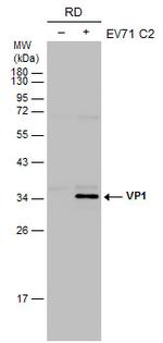 Enterovirus 71 VP1 Monoclonal Antibody (GT185)