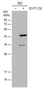 Enterovirus 71 VP1 Monoclonal Antibody (GT9512)