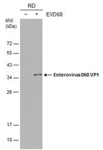 Enterovirus D68 VP1 Antibody in Western Blot (WB)
