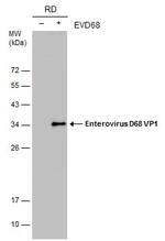 Enterovirus D68 VP1 Monoclonal Antibody (GT11610)