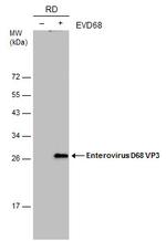 Enterovirus D68 VP3 Monoclonal Antibody (GT1665)