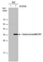 Enterovirus D68 VP1 Monoclonal Antibody (GT1843)