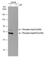Phospho-Zap-70 (Tyr319, Tyr352) Monoclonal Antibody (GT364)