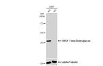 beta Dystroglycan Antibody in Western Blot (WB)