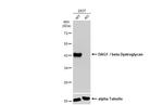 beta Dystroglycan Monoclonal Antibody (GT2812)