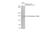 Phospho-EGFR (Thr669) Antibody in Western Blot (WB)