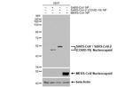 SARS-CoV/SARS-CoV-2 Nucleocapsid Antibody in Western Blot (WB)