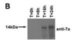 SARS-CoV/SARS-CoV-2 ORF7a Antibody in Western Blot (WB)