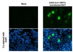 SARS-CoV/SARS-CoV-2 ORF7a Antibody in Immunocytochemistry (ICC/IF)