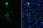 SARS/SARS-CoV-2 Spike Protein S2 Antibody in Immunocytochemistry (ICC/IF)