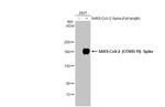 SARS/SARS-CoV-2 Spike Protein S2 Antibody in Western Blot (WB)