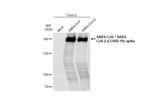 SARS/SARS-CoV-2 Spike Protein S2 Antibody in Western Blot (WB)