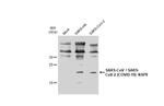 SARS-CoV/SARS-CoV-2 NSP8 Antibody in Western Blot (WB)