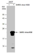 SARS-CoV/SARS-CoV-2 NSP8 Antibody in Western Blot (WB)