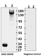 SARS-CoV-2 Spike Protein (S1/S2) Monoclonal Antibody (bcb01)