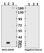 SARS-CoV-2 Spike Protein (S1/S2) Monoclonal Antibody (bcb02)