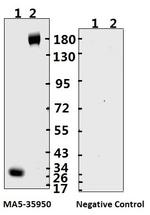 SARS-CoV-2 Spike Protein (S1/S2) Antibody in Western Blot (WB)