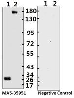 SARS-CoV-2 Spike Protein (S1/S2) Monoclonal Antibody (bcb04)