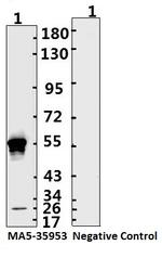 SARS-CoV-2 Nucleocapsid Monoclonal Antibody (bcn11)