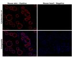 Cytokeratin 14 Recombinant Rabbit Monoclonal Antibody (101)
