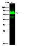 Cytokeratin 5 Antibody in Western Blot (WB)