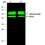 CCR1 Antibody in Immunoprecipitation (IP)