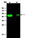 CCR1 Recombinant Rabbit Monoclonal Antibody (002)