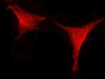 Leptin Recombinant Rabbit Monoclonal Antibody (002)