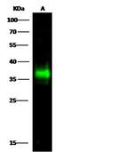 CD7 Recombinant Rabbit Monoclonal Antibody (307)