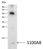 S100A8 Antibody in Immunoprecipitation (IP)