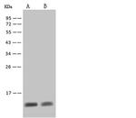 S100A8 Recombinant Rabbit Monoclonal Antibody (203)