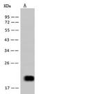 IL-5 Recombinant Rabbit Monoclonal Antibody (225)