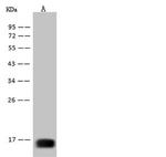 West Nile Virus Envelope (Domain III) (lineage 1, strain NY99) Monoclonal Antibody (15)