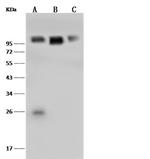 CD106 (VCAM-1) Antibody in Western Blot (WB)