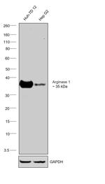 Arginase 1 Antibody in Western Blot (WB)