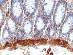 Caldesmon Antibody in Immunohistochemistry (Paraffin) (IHC (P))