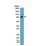 Caldesmon Antibody in Western Blot (WB)