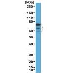 FOXP1 Antibody in Western Blot (WB)