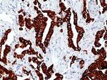 Cytokeratin 7 Recombinant Rabbit Monoclonal Antibody (RM416)