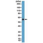 Cytokeratin 7 Antibody in Western Blot (WB)