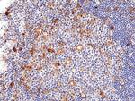 CD25 Antibody in Immunohistochemistry (Paraffin) (IHC (P))