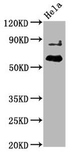 Phospho-AKT1 (Thr450) Recombinant Rabbit Monoclonal Antibody (2A4)