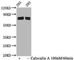 Phospho-PAK4/6/7 (Ser474, Ser602, Ser560) Antibody in Western Blot (WB)