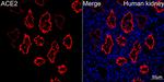ACE2 Antibody in Immunocytochemistry (ICC/IF)