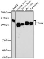 ACE2 Antibody in Western Blot (WB)