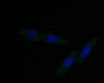 DFNA5 Monoclonal Antibody (A1H3)